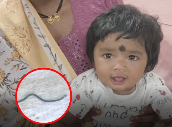 9 माह की बच्ची ने करैत सांप को कांटा