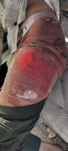 रायपुर युवक चाकू हमला