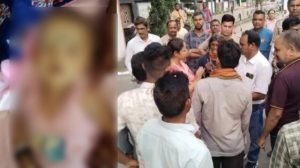 आंगनबाड़ी टीका लगाने से बच्ची की मौत