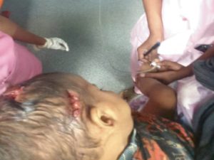 Raipur Birgaon dog bite case