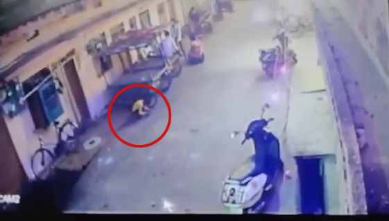 Durg News: पटाखे से जला मासूम बच्चे का चेहरा और हाथ, CCTV फुटेज आया सामने