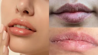 Lips Care in Winter: ठंड में होंठों को फटने से बचाएं, गुलाबी और मुलायम बनाए रखने के लिए जानें आसान घरेलू उपाय