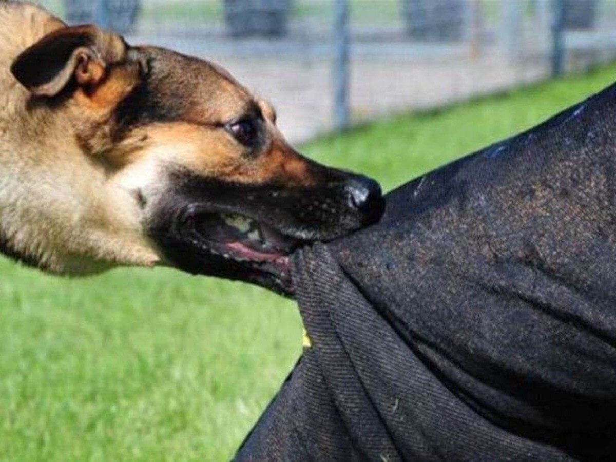 Dhamtari News: 5 साल की मासूम को आवारा कुत्ता ने काटा; सिर और हाथ में गंभीर चोट, रायपुर रेफर