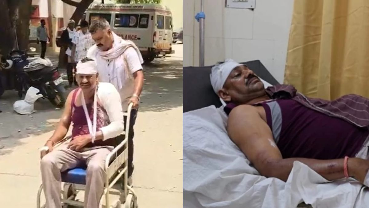 CG Police Attack: आरोपी को पकड़ने गई पुलिस टीम पर हमला; चोर समझकर ग्रामीणों ने पीटा, आरक्षक गंभीर