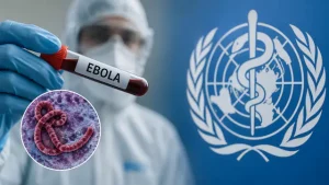 ebola virus