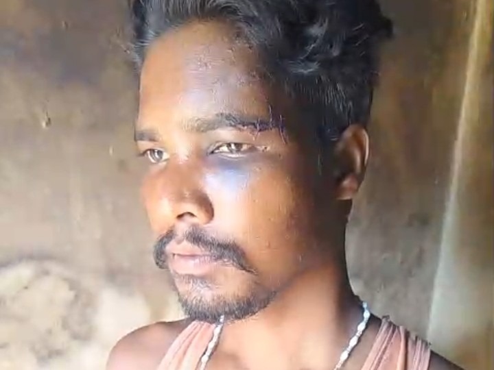 CG News: चिकन का पूछा भाव तो दुकानदार और बेटे ने जमकर की पिटाई
