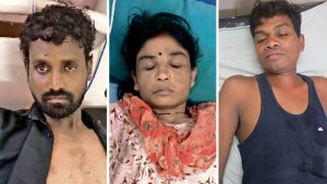 Bilaspur Accident: हाईटेंशन तार की चपेट में आए 5 मजदूर, पोल लगाते समय हुआ हादसा 11 07 2026 Sirgitti Accident High Tension Line 300x169