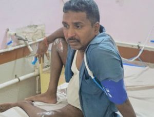 Bilaspur Accident: हाईटेंशन तार की चपेट में आए 5 मजदूर, पोल लगाते समय हुआ हादसा Image 64 3 300x228