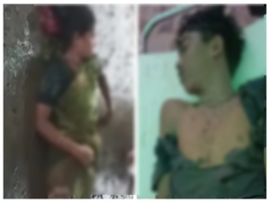 CG Lightning Strike: मनेन्द्रगढ़ जिले के खड़गवां ब्लॉक में आकाशीय बिजली गिरने से अलग-अलग स्थानों पर तीन लोगों की मौत हो गई, जबकि पांच लोग झुलस गए। घटना के बाद पूरे इलाके में दहशत का माहौल है। घायलों को अस्पताल में भर्ती कराया गया है, जहां उनका उपचार जारी है।