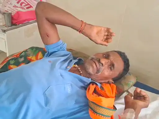 CG Bear Attack: बालोद जिले के डौंडीलोहारा विकासखंड के ग्राम पंचायत भंवरमला के आश्रित ग्राम रायगढ़ में जंगल में शौच के लिए गए एक ग्रामीण पर भालू ने हमला कर दिया। हमले में 60 वर्षीय ग्रामीण गंभीर रूप से घायल हो गए। उनके कंधे समेत शरीर के कई हिस्सों में चोटें आई हैं। घायल का डौंडीलोहारा अस्पताल में उपचार जारी है।