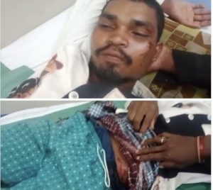 CG News: छत्तीसगढ़ के बिलासपुर जिले में हरेली पर्व के दौरान मुर्गे को लेकर दो सगे भाइयों के बीच विवाद हो गया। विवाद इतना बढ़ गया कि बड़े भाई ने छोटे भाई पर चाकू से हमला कर दिया। हमले में छोटा भाई गंभीर रूप से घायल हो गया, जिसे उपचार के लिए सिम्स अस्पताल में भर्ती कराया गया है। मामला सरकंडा थाना क्षेत्र के मोपका चौकी अंतर्गत ग्राम चिल्हाटी का है।