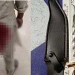Raipur Chakubaji: रायपुर में चाकूबाजी की घटनाएं थमने का नाम नहीं ले रही हैं। बुधवार सुबह आजाद चौक थाना क्षेत्र के तात्यापारा इलाके में ईद के जुलूस के दौरान पुरानी रंजिश को लेकर हुए विवाद में चाकूबाजी और मारपीट की घटना सामने आई। घटना में तीन युवक घायल हुए हैं, जिनमें एक को चाकू लगा है।