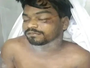 Raipur Current Accident: छत्तीसगढ़ की राजधानी रायपुर के टिकरापारा थाना क्षेत्र से एक दर्दनाक घटना सामने आई है। जहां करंट की चपेट में आने से मां और बेटे की मौके पर ही मौत हो गई। बताया जा रहा है कि महिला बालकनी में सूखने के लिए टंगे कपड़े निकालने गई थी। इसी दौरान वह करंट की चपेट में आ गई। मां को करंट से चिपका देखकर उसे बचाने पहुंचे 23 वर्षीय बेटे की भी करंट लगने से मौत हो गई।