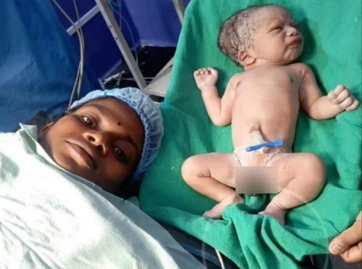 CG Bharthari Video: बालोद जिले से एक अनोखा वीडियो सामने आया है, जिसे सोशल मीडिया पर लोग खूब पसंद कर रहे हैं। जिला मुख्यालय स्थित उम्मीद हॉस्पिटल में सिजेरियन डिलीवरी के दौरान छत्तीसगढ़ की प्रसिद्ध भरथरी गायिका हेमलता पटेल ने ऑपरेशन थिएटर में ही भरथरी गीत गाना शुरू कर दिया।