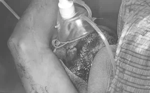 Raipur Murder: राजधानी रायपुर के झूलेलाल चौक के पास स्थित बंसल पैराडाइज होटल के एक कमरे से युवती का शव मिलने से सनसनी फैल गई। उसी कमरे में एक युवक गंभीर रूप से घायल अवस्था में मिला है। घटना गंज थाना क्षेत्र की है। सूचना मिलने पर पुलिस और FSL की टीम मौके पर पहुंची और जांच शुरू कर दी।