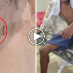 CG Dog Attack: छत्तीसगढ़ के सारंगढ़-बिलाईगढ़ जिले में एक पागल कुत्ते ने लोगों में दहशत फैला दी है। आवारा कुत्ते ने वार्ड क्रमांक 1, 2, 3 और 4 में घूम-घूमकर 31 लोगों को काटकर घायल कर दिया। घायलों में बच्चे, महिलाएं और बुजुर्ग भी शामिल हैं। सभी को इलाज के लिए अस्पताल पहुंचाया गया है।