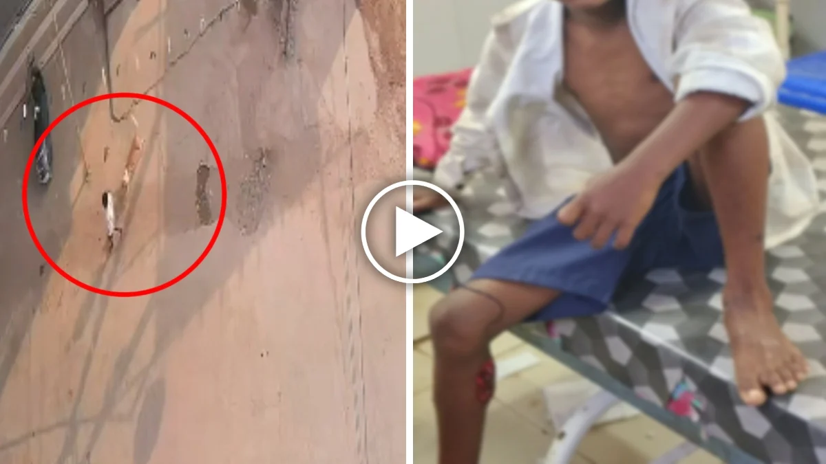 CG Dog Attack: छत्तीसगढ़ के सारंगढ़-बिलाईगढ़ जिले में एक पागल कुत्ते ने लोगों में दहशत फैला दी है। आवारा कुत्ते ने वार्ड क्रमांक 1, 2, 3 और 4 में घूम-घूमकर 31 लोगों को काटकर घायल कर दिया। घायलों में बच्चे, महिलाएं और बुजुर्ग भी शामिल हैं। सभी को इलाज के लिए अस्पताल पहुंचाया गया है।