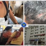Raipur News: रायपुर के पेंशनबाड़ा चौक में गणेश फ्लैक्स-बैनर लगाने को लेकर दो पक्षों के बीच विवाद हिंसक झड़प में बदल गया। बुधवार शाम करीब 4:30 बजे हुई इस घटना में दोनों पक्षों ने एक-दूसरे पर गाली-गलौज, जान से मारने की धमकी देने और लाठी-डंडे, रॉड, सब्बल व पत्थरों से हमला करने का आरोप लगाया है। मारपीट में दोनों पक्षों के कई लोग घायल हुए हैं। कोतवाली थाना पुलिस ने दोनों पक्षों की शिकायत पर कुल पांच लोगों के खिलाफ मामला दर्ज कर जांच शुरू कर दी है।