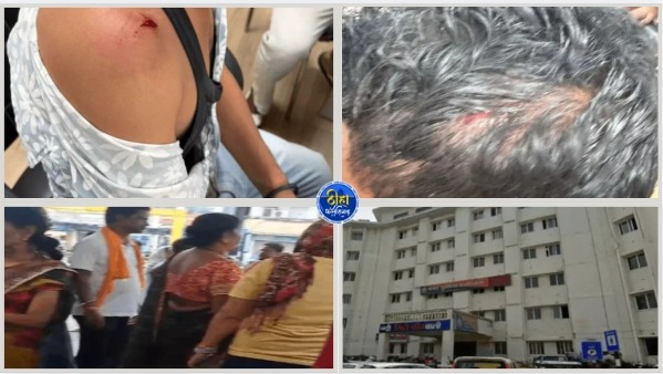 Raipur News: रायपुर के पेंशनबाड़ा चौक में गणेश फ्लैक्स-बैनर लगाने को लेकर दो पक्षों के बीच विवाद हिंसक झड़प में बदल गया। बुधवार शाम करीब 4:30 बजे हुई इस घटना में दोनों पक्षों ने एक-दूसरे पर गाली-गलौज, जान से मारने की धमकी देने और लाठी-डंडे, रॉड, सब्बल व पत्थरों से हमला करने का आरोप लगाया है। मारपीट में दोनों पक्षों के कई लोग घायल हुए हैं। कोतवाली थाना पुलिस ने दोनों पक्षों की शिकायत पर कुल पांच लोगों के खिलाफ मामला दर्ज कर जांच शुरू कर दी है।