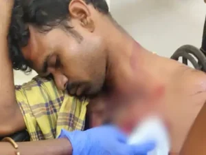 CG Bear Attack: सुकमा जिले के पालामडगू गांव में मवेशी चराने गए दो ग्रामीणों पर भालू ने हमला कर दिया। इस घटना में दोनों ग्रामीण घायल हो गए। घायलों को इलाज के लिए अस्पताल पहुंचाया गया, जहां प्राथमिक उपचार के बाद बेहतर इलाज के लिए रेफर करने की तैयारी की जा रही है। मामला पोलमपल्ली थाना क्षेत्र का है।